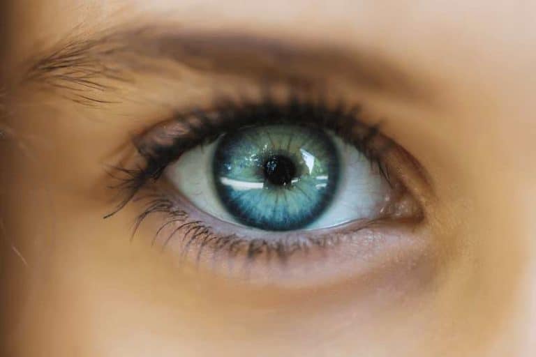 Зачервени очи – каква е причината?