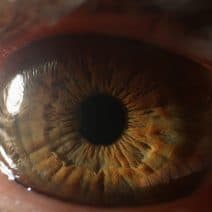 откриване на глаукома