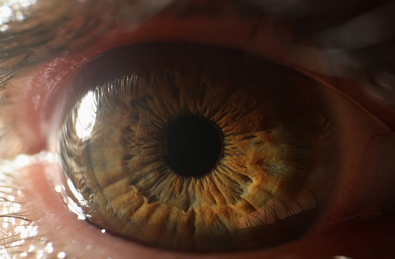 Откриване на глаукома – трябва да е навреме!